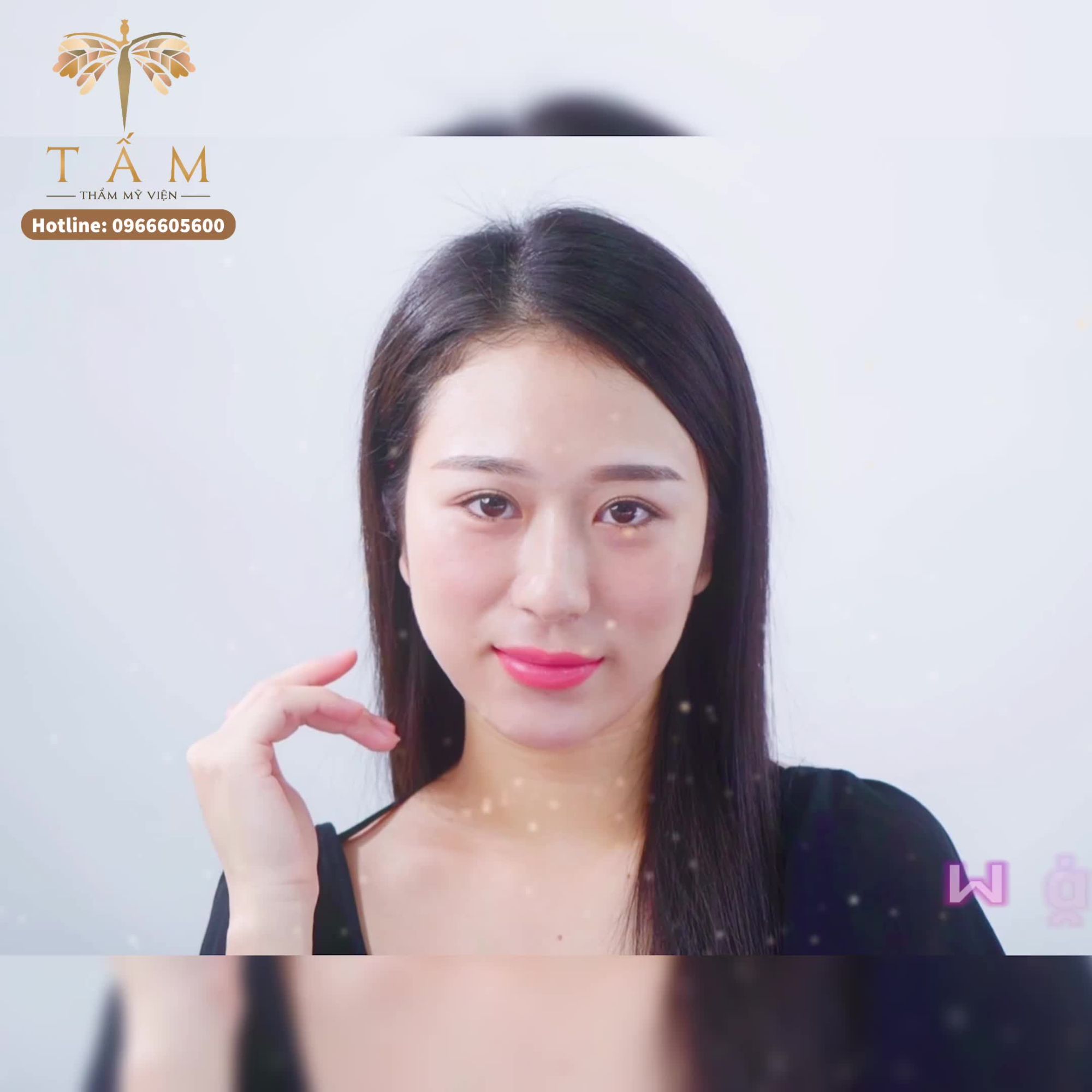 MẶT BẠNH TO KHIẾN BẠN ĐẮN ĐO
